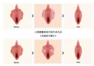 私密清秀作用,清秀肌肤的秘密武器